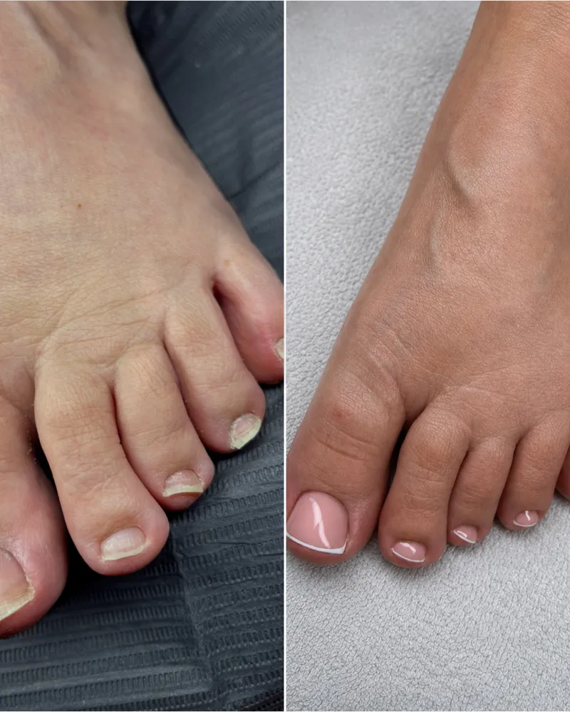 Verzorgde teennagels met gellak